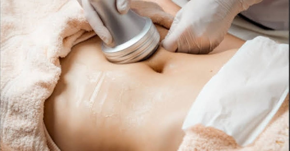 360 Body Lift treatment