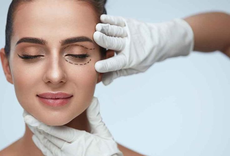 Blepharoplasty treatment