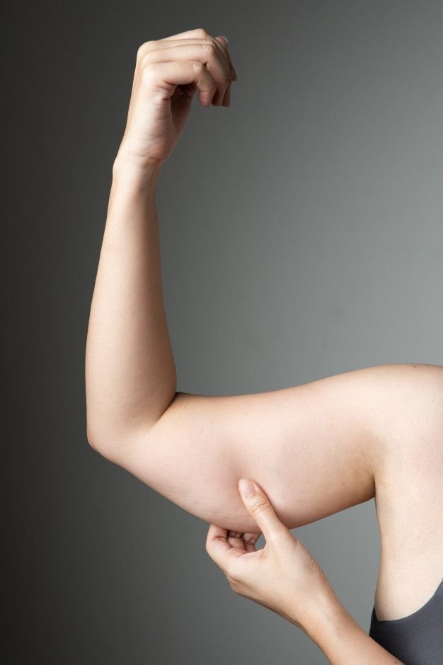 Brachioplasty treatment