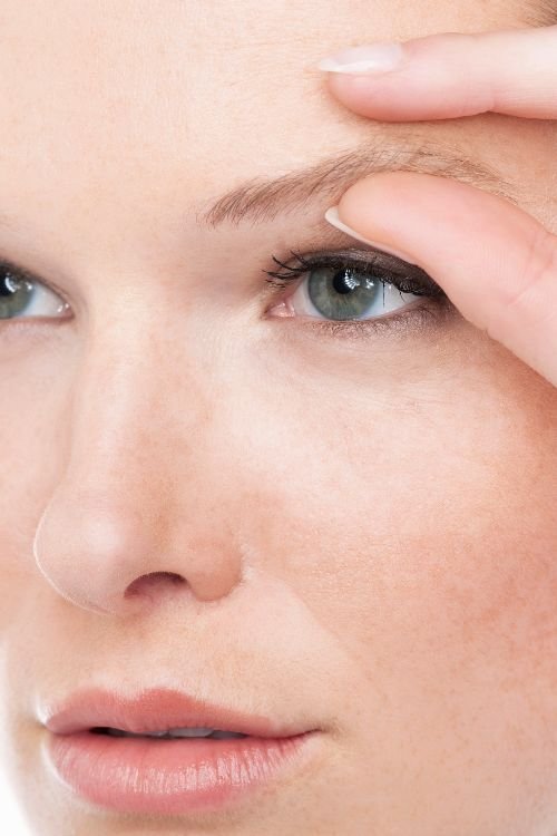 Brow Lift treatment