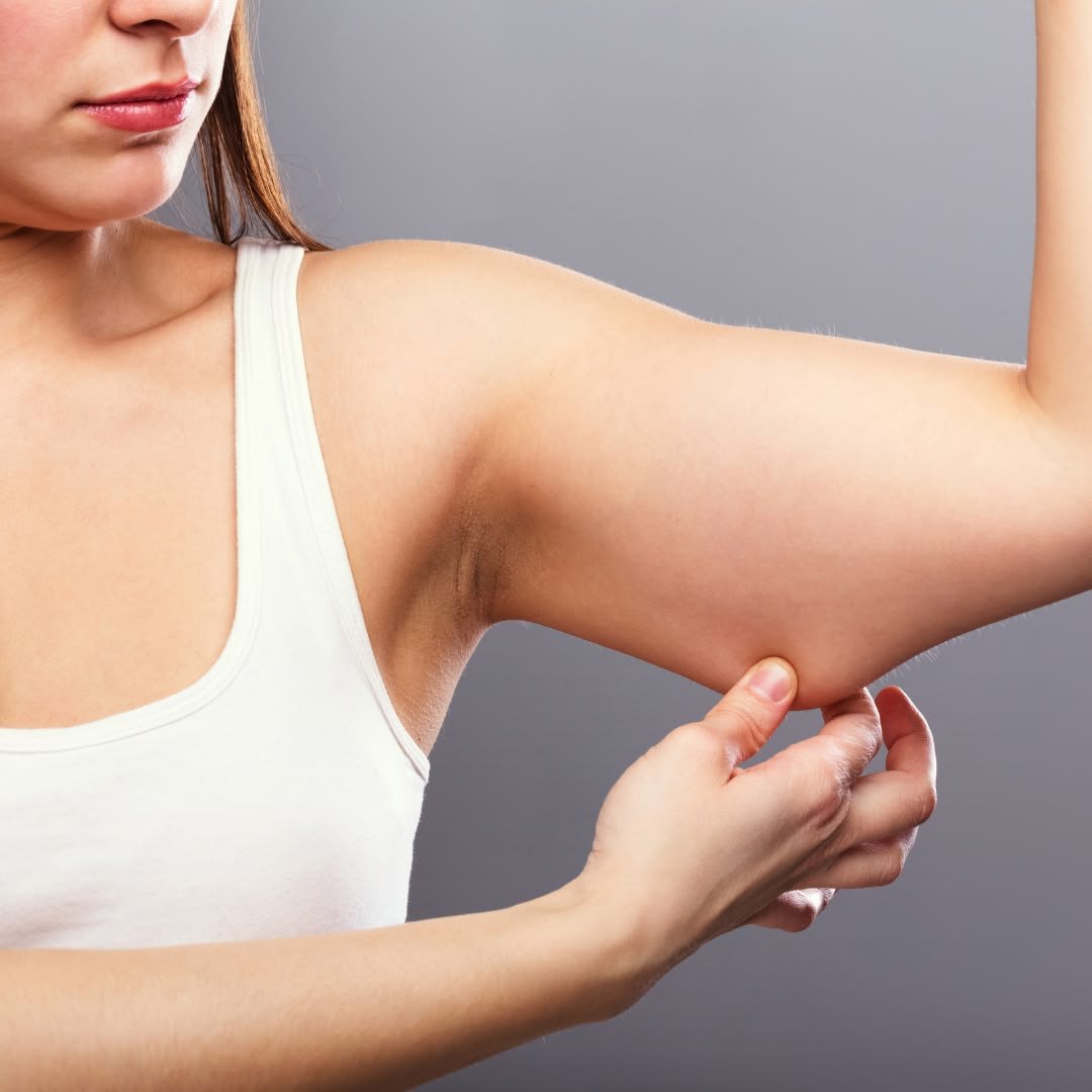 Fat Transfer treatment
