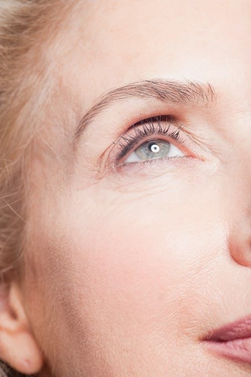 Lower Blepharoplasty treatment
