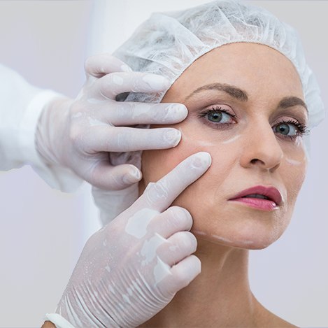 Lower Blepharoplasty