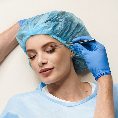 Upper Blepharoplasty-1