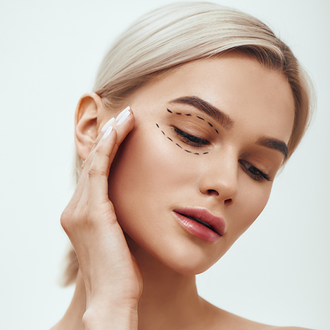 Upper Blepharoplasty